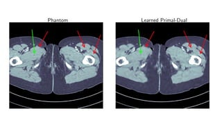 Phantom Learned Primal-Dual
 