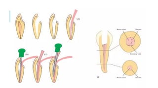 introduction to ENDODONTICS for 2nd year bds | PPTX