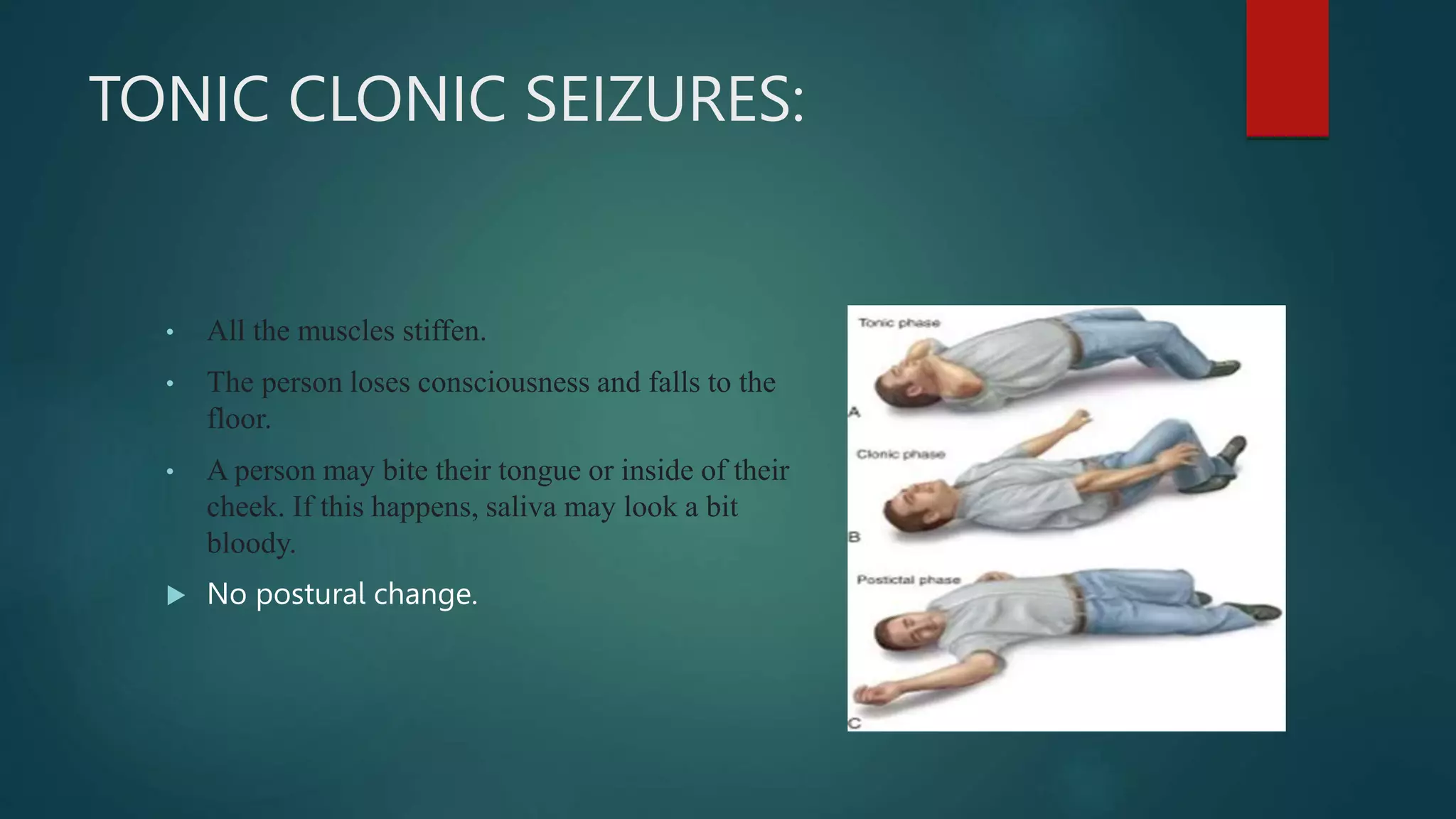 TONIC CLONIC SEIZURES:
• All the muscles stiffen.
• The person loses consciousness and falls to the
floor.
• A person may bite their tongue or inside of their
cheek. If this happens, saliva may look a bit
bloody.
 No postural change.
 
