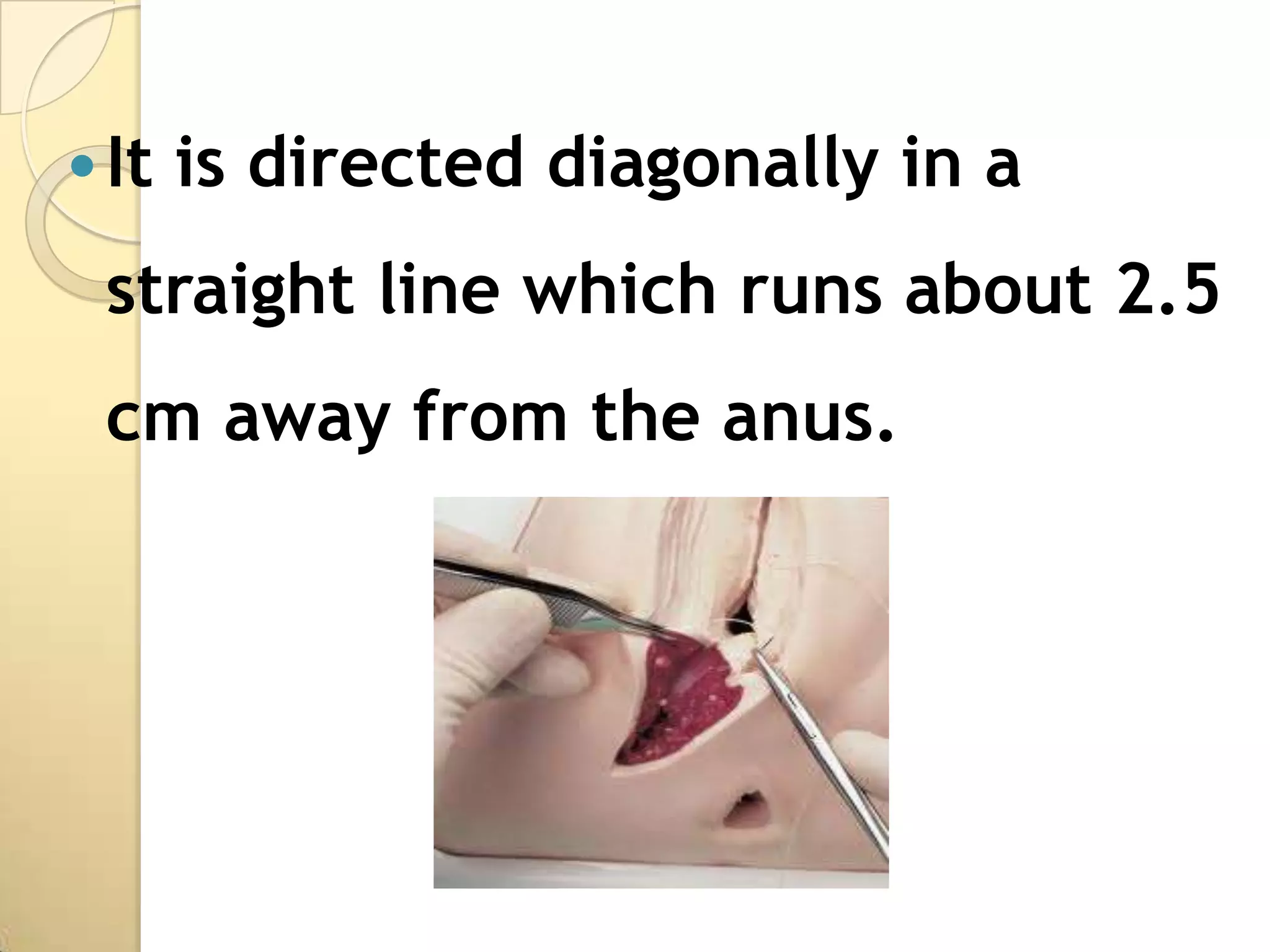  It   is directed diagonally in a
 straight line which runs about 2.5
 cm away from the anus.
 