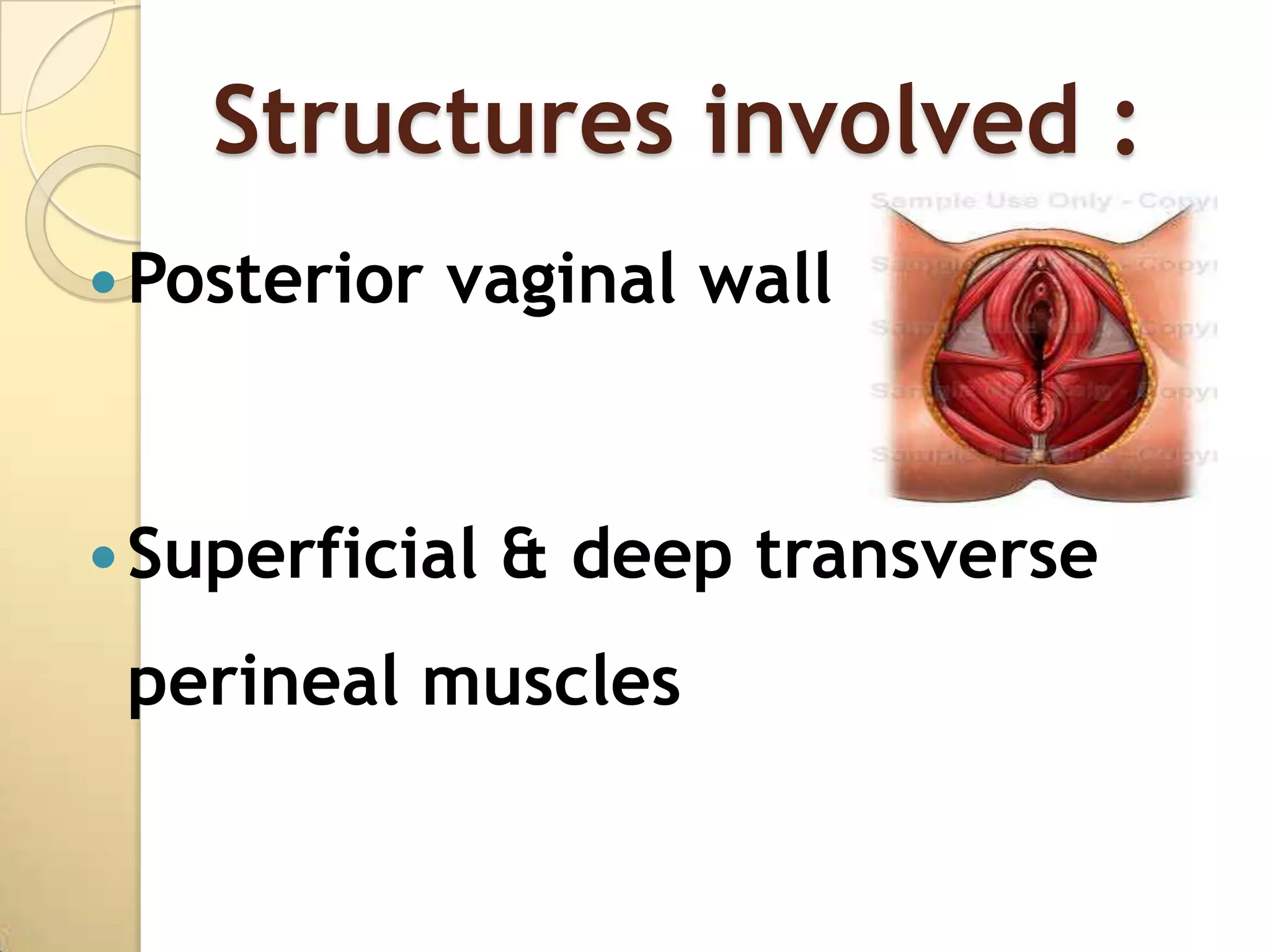 Structures involved :
 Posterior   vaginal wall


 Superficial   & deep transverse
 perineal muscles
 