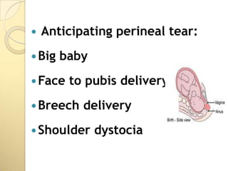    Anticipating perineal tear:
 Big   baby
 Face   to pubis delivery
 Breech   delivery
 Shoulder     dystocia
 