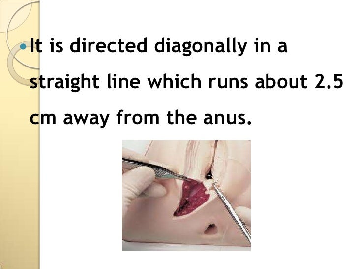 Presentation episiotomy