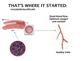 THAT’S WHERE IT STARTED:
Healthy Cells
Good blood flow.
Optimum oxygen
and nutrient
www.ganoderma-coffee.info
 