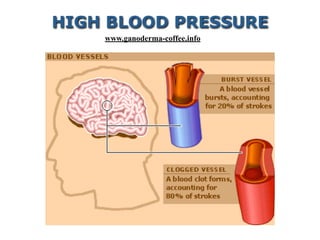 HIGH BLOOD PRESSURE
www.ganoderma-coffee.info
 