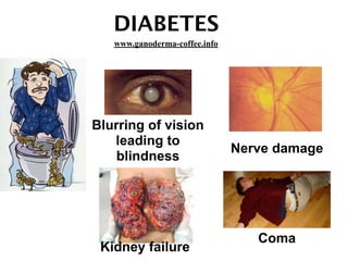DIABETES
Coma
Blurring of vision
leading to
blindness
Nerve damage
Kidney failure
www.ganoderma-coffee.info
 