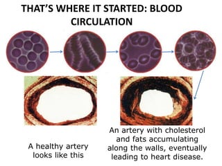 THAT’S WHERE IT STARTED: BLOOD
CIRCULATION
A healthy artery
looks like this
An artery with cholesterol
and fats accumulating
along the walls, eventually
leading to heart disease.
 