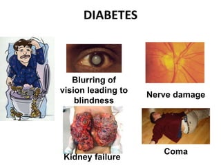 DIABETES
Coma
Blurring of
vision leading to
blindness
Nerve damage
Kidney failure
 