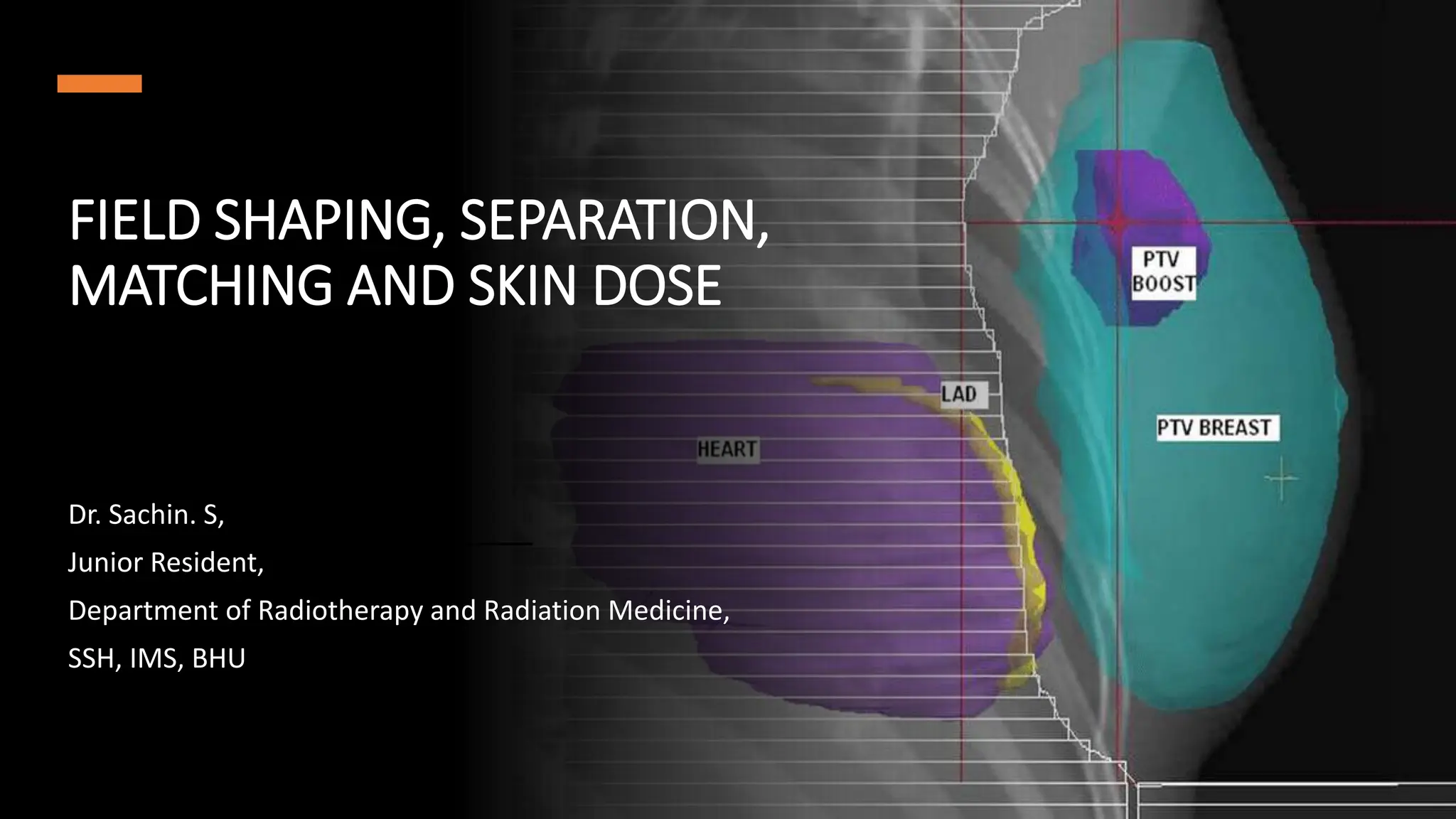Treatment planning in Radiotherapy - field shaping, separation and ...