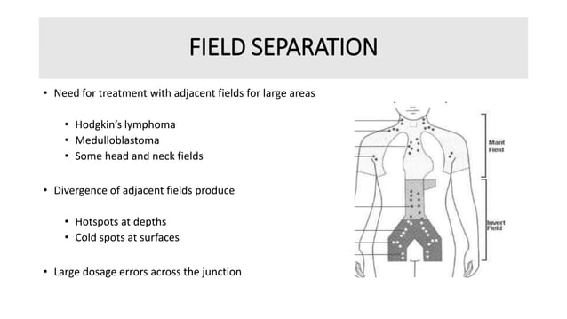 Split Field Radiotherapy Treatment planning in Radiotherapy - field shaping, separation and ...