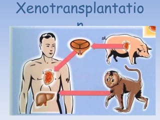 Xenotransplantatio
n
 