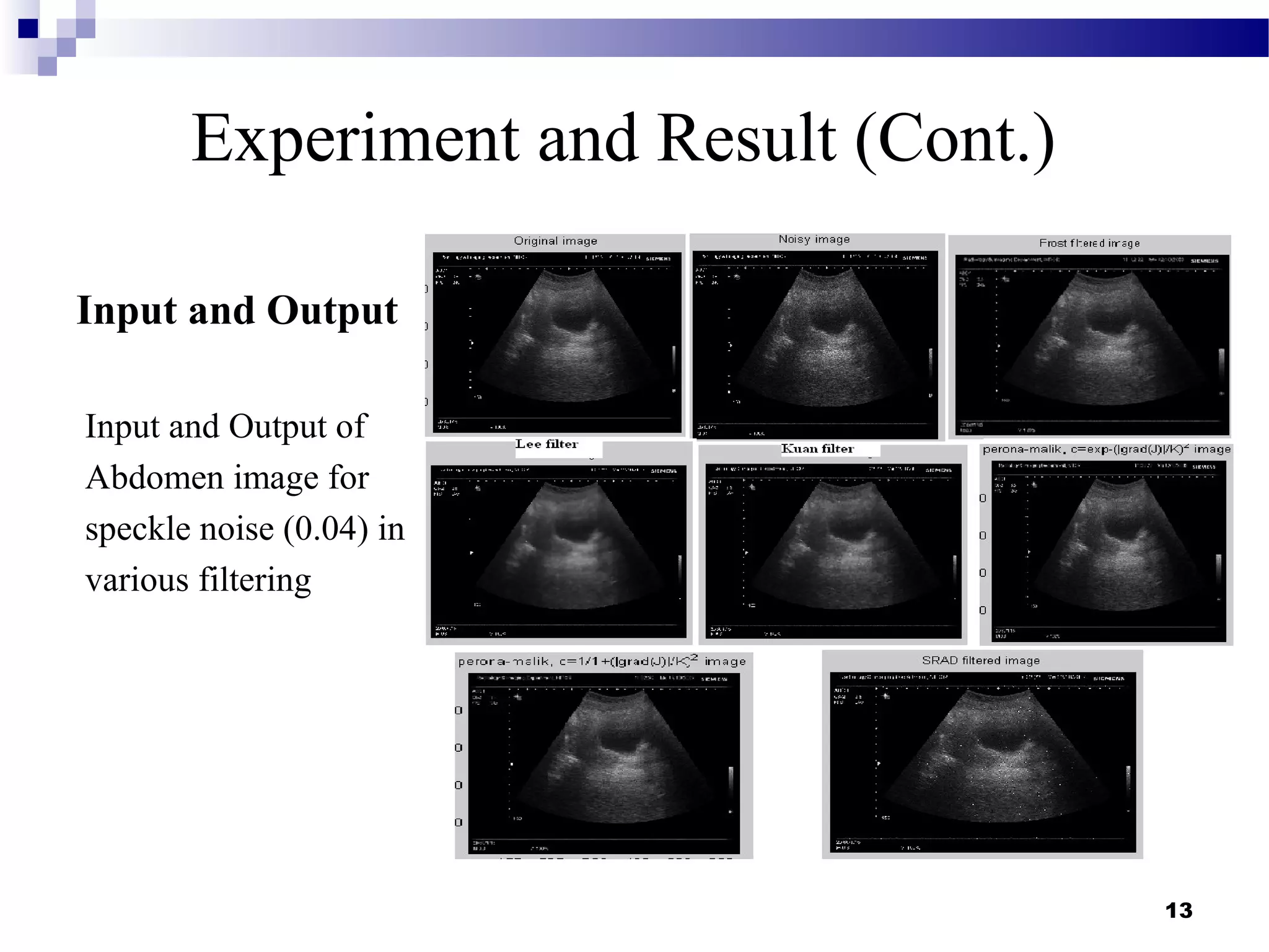 13
Experiment and Result (Cont.)
Input and Output
Input and Output of
Abdomen image for
speckle noise (0.04) in
various filtering
 