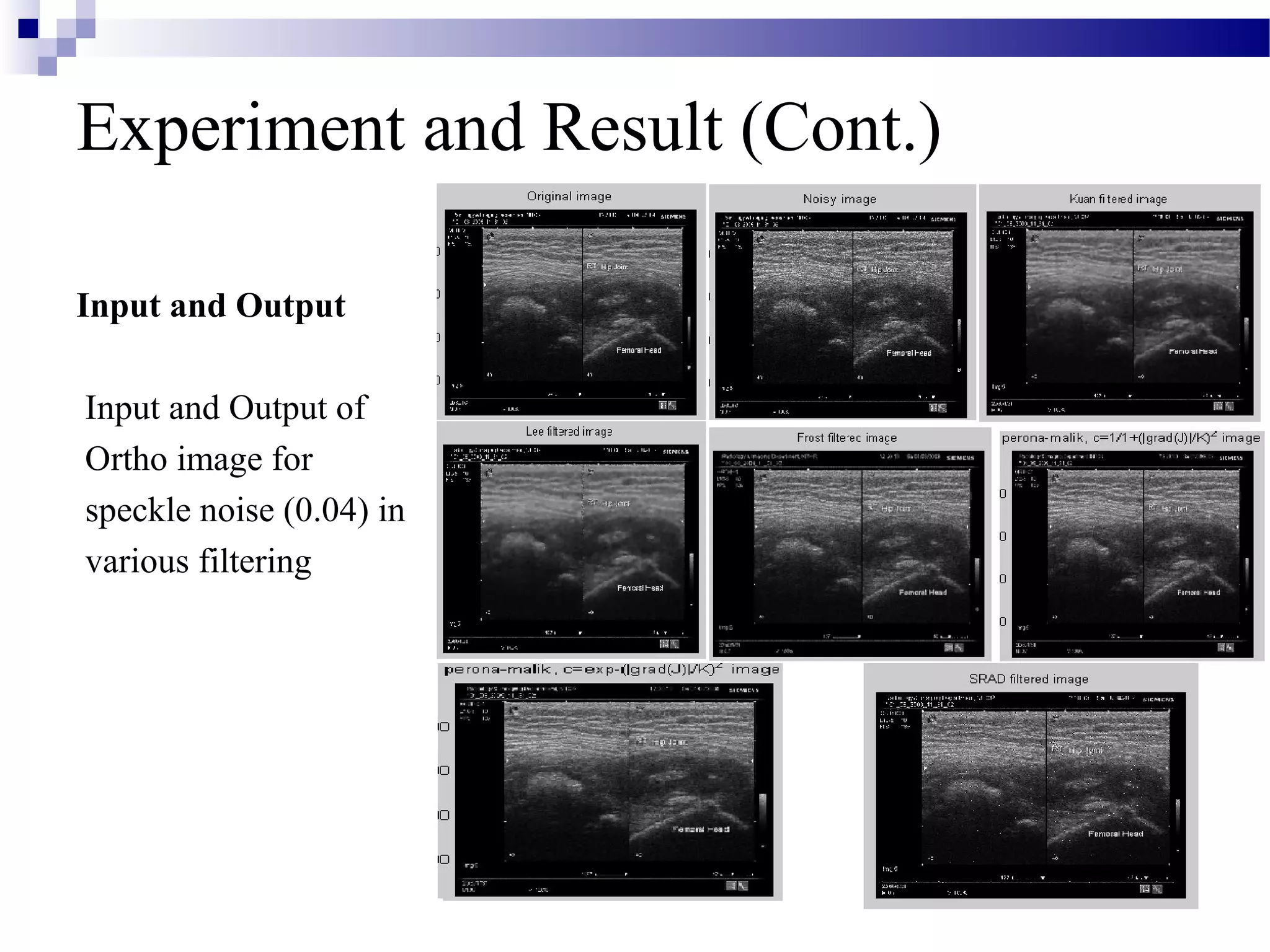 Experiment and Result (Cont.)
Input and Output
Input and Output of
Ortho image for
speckle noise (0.04) in
various filtering
 