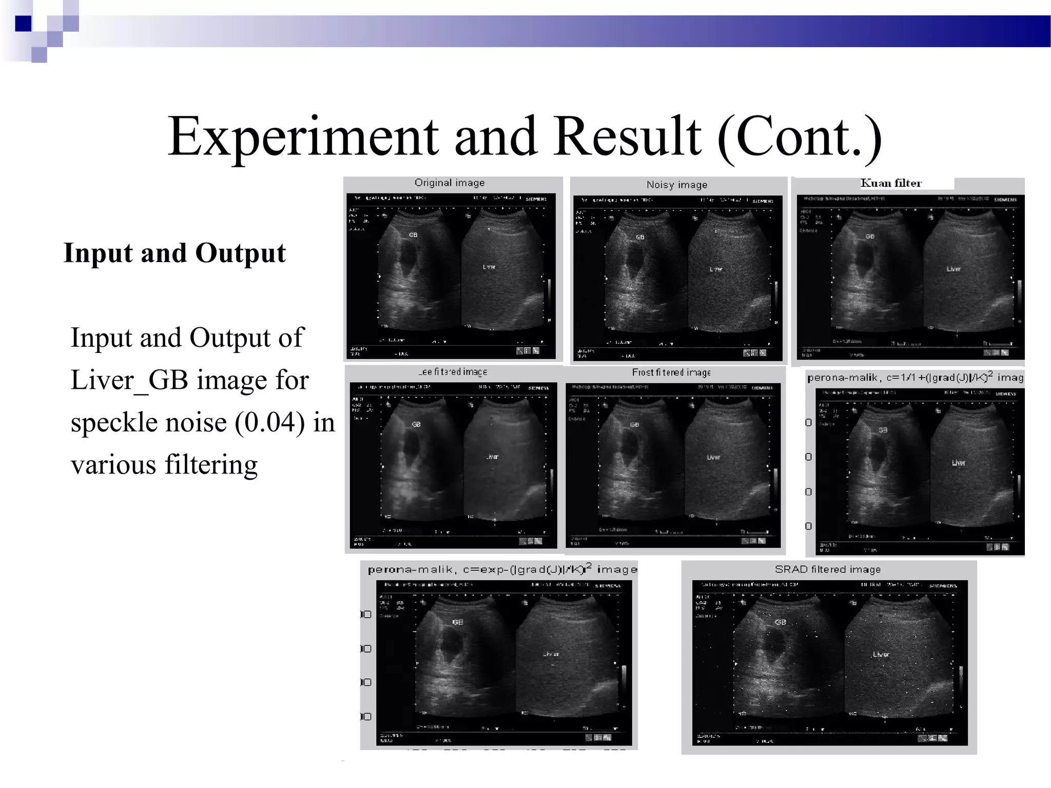 Experiment and Result (Cont.)
Input and Output
Input and Output of
Liver_GB image for
speckle noise (0.04) in
various filtering
 
