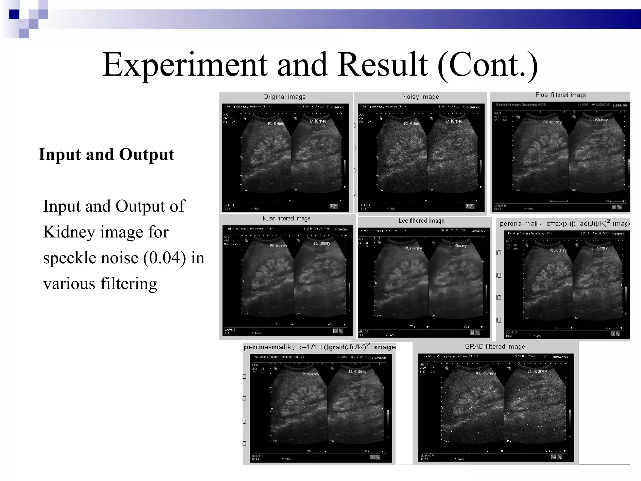 Experiment and Result (Cont.)
Input and Output
Input and Output of
Kidney image for
speckle noise (0.04) in
various filtering
 