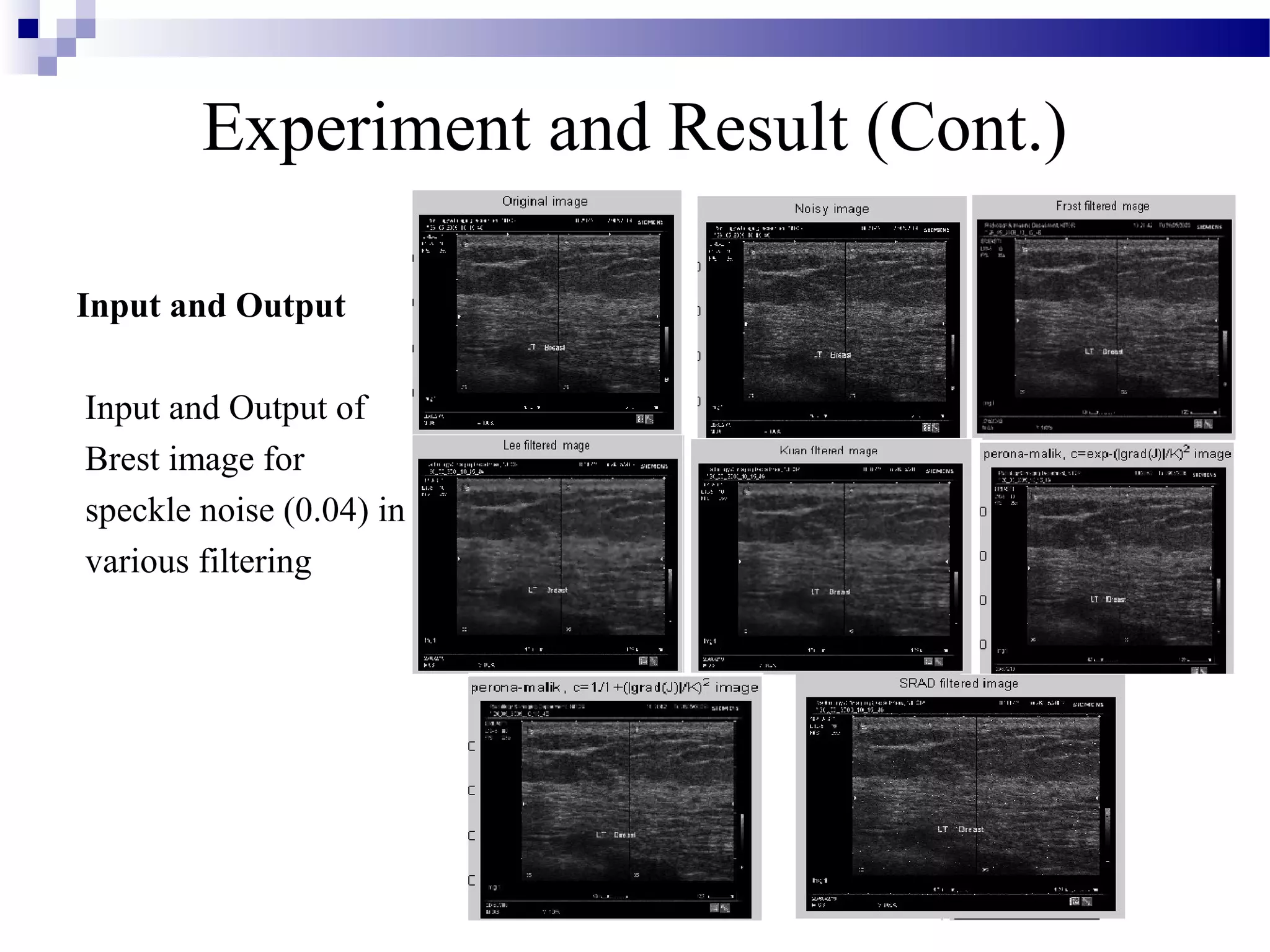 Experiment and Result (Cont.)
Input and Output
Input and Output of
Brest image for
speckle noise (0.04) in
various filtering
 