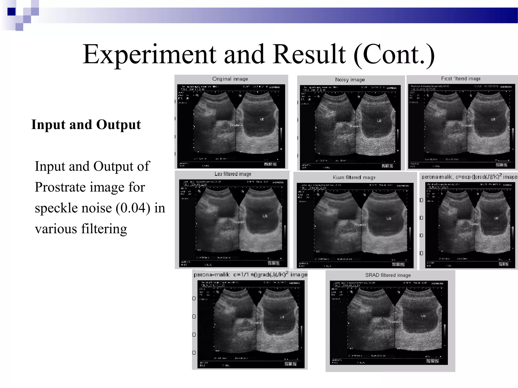 Experiment and Result (Cont.)
Input and Output
Input and Output of
Prostrate image for
speckle noise (0.04) in
various filtering
 
