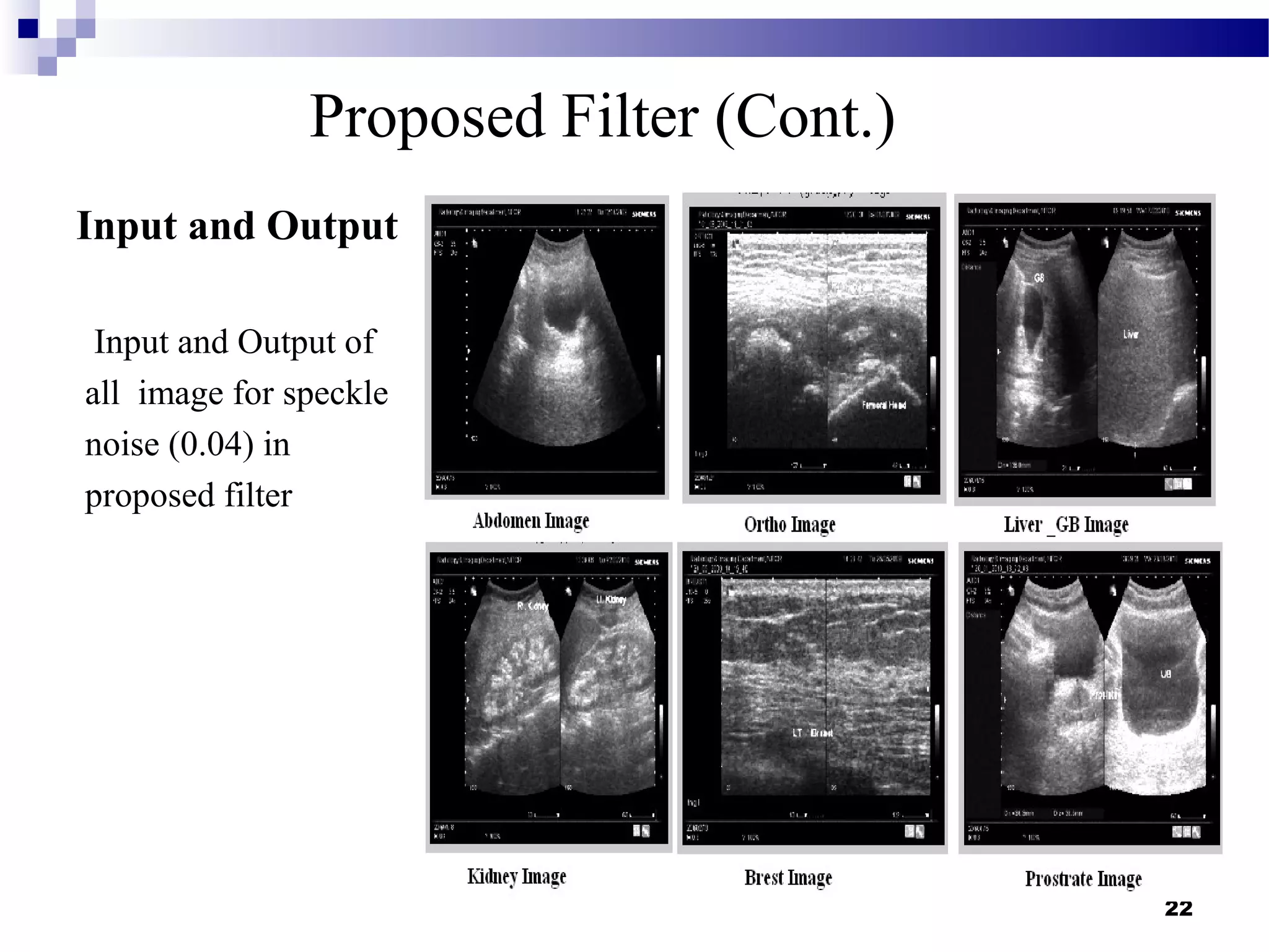 22
Proposed Filter (Cont.)
Input and Output
Input and Output of
all image for speckle
noise (0.04) in
proposed filter
 