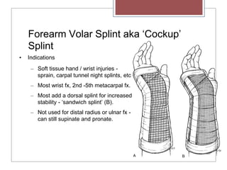 Forearm Volar Splint aka ‘Cockup’
Splint
• Indications
– Soft tissue hand / wrist injuries -
sprain, carpal tunnel night splints, etc
– Most wrist fx, 2nd -5th metacarpal fx.
– Most add a dorsal splint for increased
stability - ‘sandwich splint’ (B).
– Not used for distal radius or ulnar fx -
can still supinate and pronate.
 