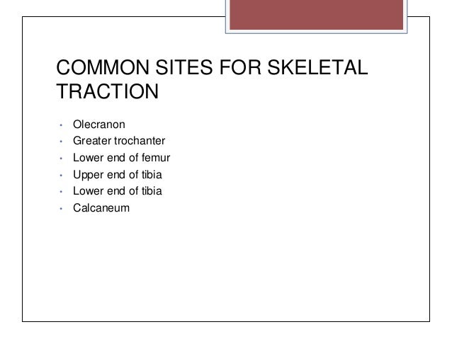 What is skeletal traction?
