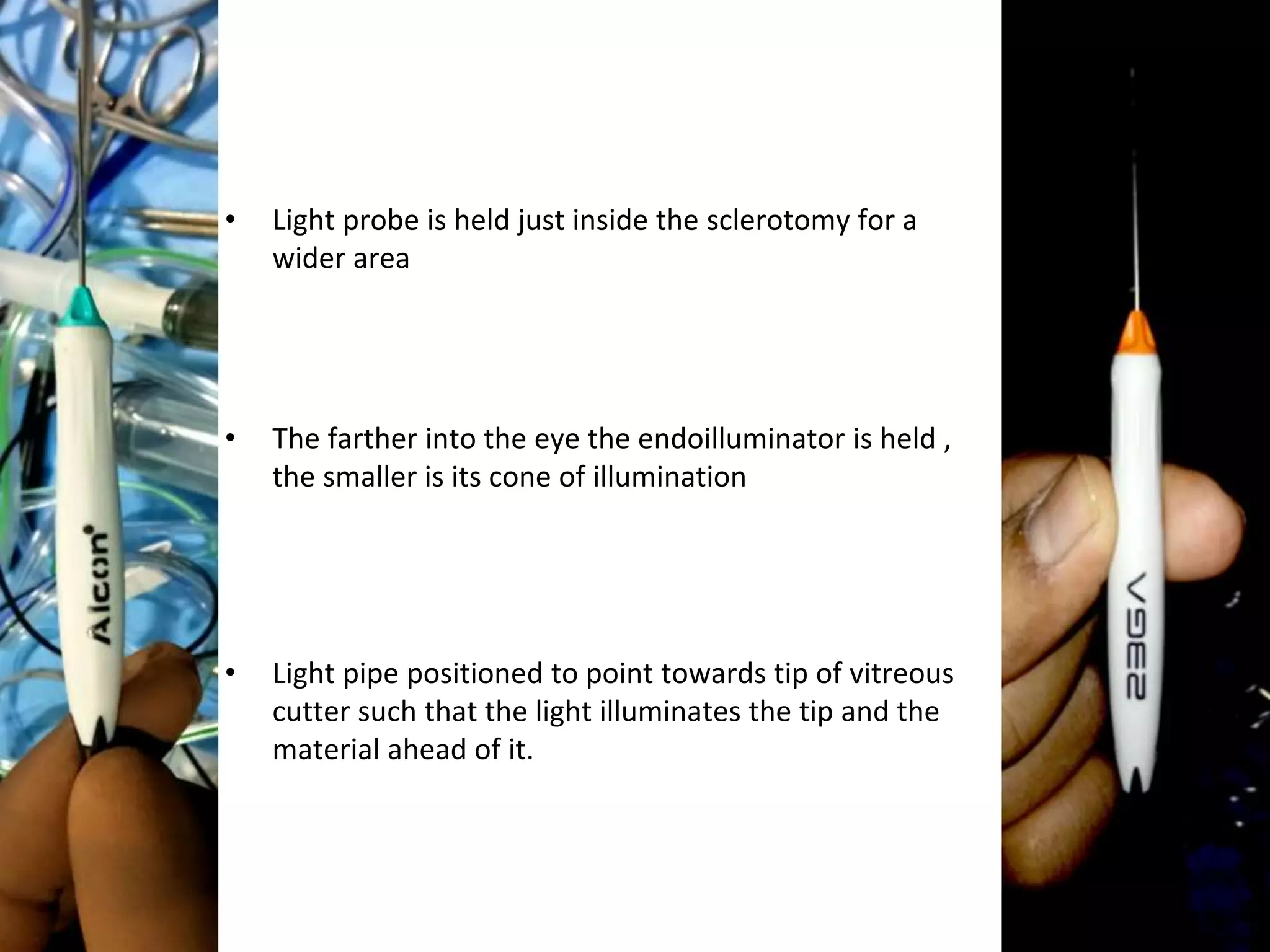 • Light probe is held just inside the sclerotomy for a
wider area
• The farther into the eye the endoilluminator is held ,
the smaller is its cone of illumination
• Light pipe positioned to point towards tip of vitreous
cutter such that the light illuminates the tip and the
material ahead of it.
 