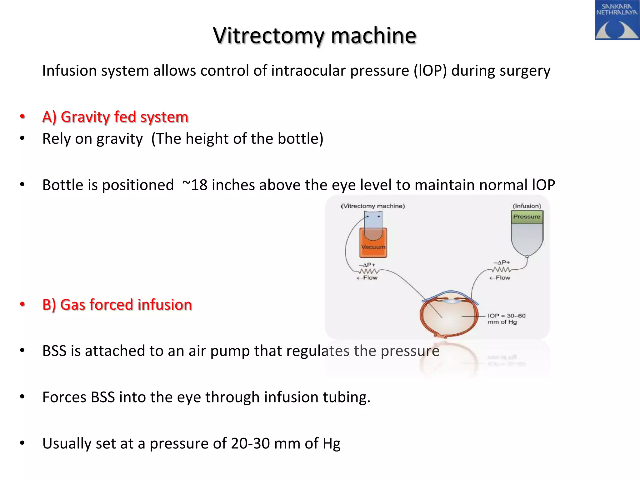 Vitrectomy machine
Infusion system allows control of intraocular pressure (lOP) during surgery
• A) Gravity fed system
• Rely on gravity (The height of the bottle)
• Bottle is positioned ~18 inches above the eye level to maintain normal lOP
• B) Gas forced infusion
• BSS is attached to an air pump that regulates the pressure
• Forces BSS into the eye through infusion tubing.
• Usually set at a pressure of 20-30 mm of Hg
 
