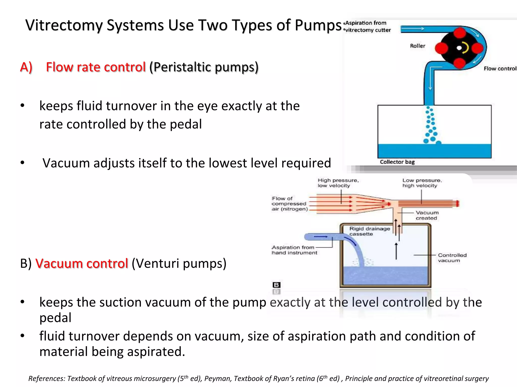 Vitrectomy Systems Use Two Types of Pumps:
A) Flow rate control (Peristaltic pumps)
• keeps fluid turnover in the eye exactly at the
rate controlled by the pedal
• Vacuum adjusts itself to the lowest level required
B) Vacuum control (Venturi pumps)
• keeps the suction vacuum of the pump exactly at the level controlled by the
pedal
• fluid turnover depends on vacuum, size of aspiration path and condition of
material being aspirated.
References: Textbook of vitreous microsurgery (5th ed), Peyman, Textbook of Ryan’s retina (6th ed) , Principle and practice of vitreoretinal surgery
 