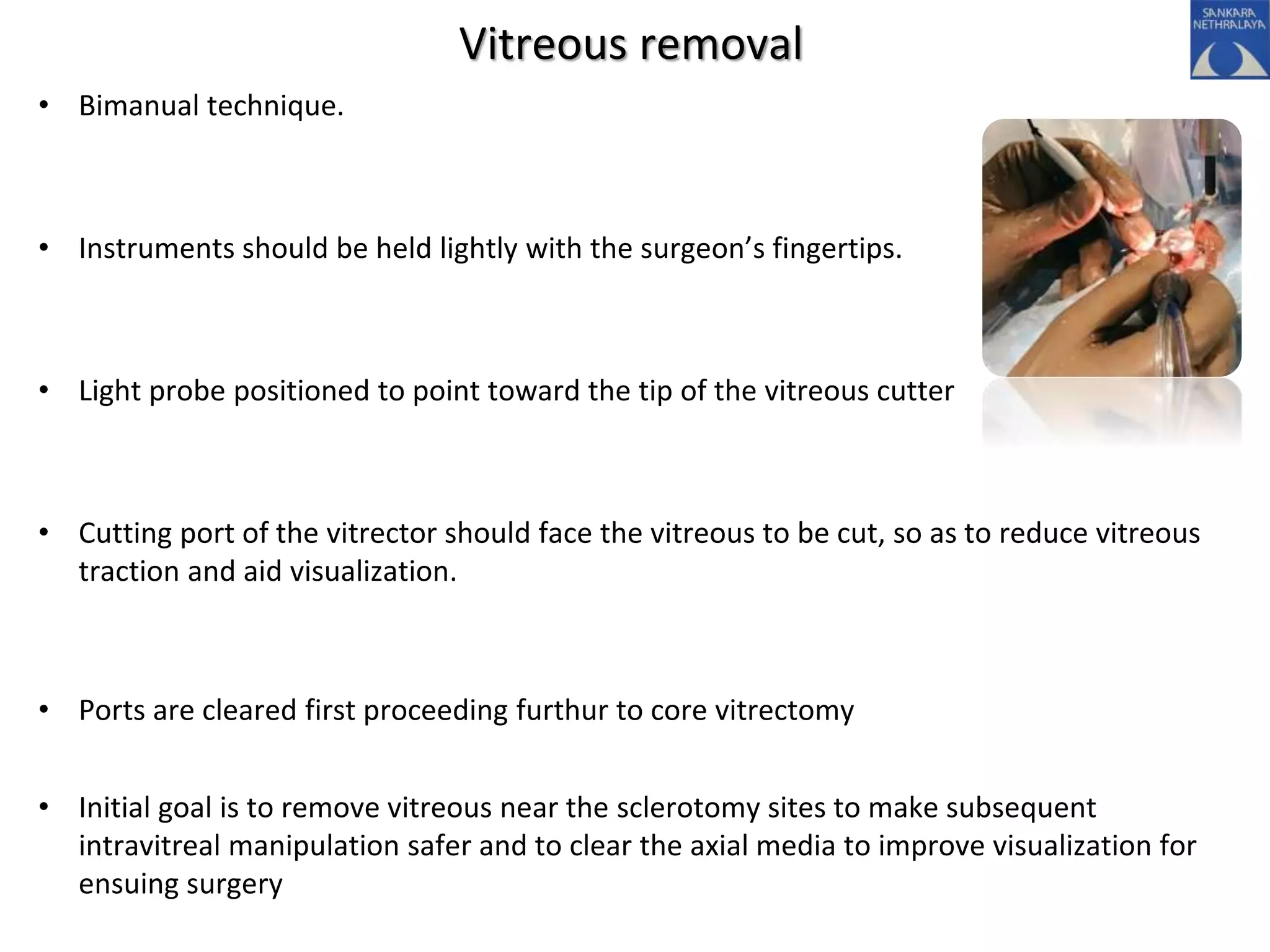 Vitreous removal
• Bimanual technique.
• Instruments should be held lightly with the surgeon’s fingertips.
• Light probe positioned to point toward the tip of the vitreous cutter
• Cutting port of the vitrector should face the vitreous to be cut, so as to reduce vitreous
traction and aid visualization.
• Ports are cleared first proceeding furthur to core vitrectomy
• Initial goal is to remove vitreous near the sclerotomy sites to make subsequent
intravitreal manipulation safer and to clear the axial media to improve visualization for
ensuing surgery
 