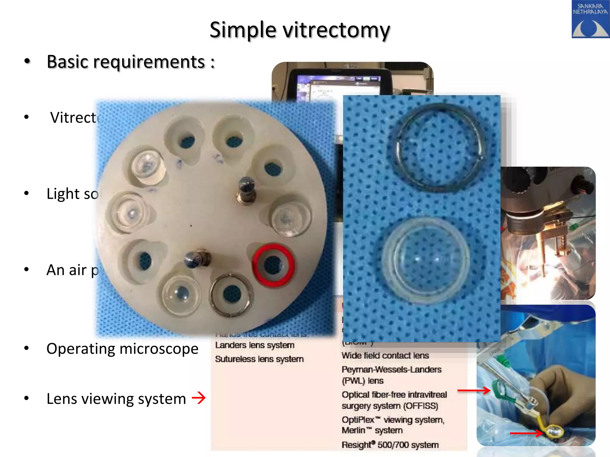 Simple vitrectomy
• Basic requirements :
• Vitrectomy machine
• Light source
• An air pump
• Operating microscope
• Lens viewing system 
 