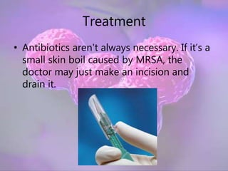 Mrsa Tabletten MRSA | PPTX