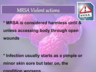 Mrsa Faq MRSA | PPTX