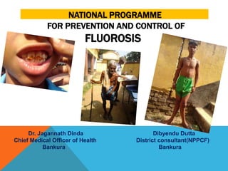 NATIONAL PROGRAMME
FOR PREVENTION AND CONTROL OF
FLUOROSIS
Dr. Jagannath Dinda Dibyendu Dutta
Chief Medical Officer of Health District consultant(NPPCF)
Bankura Bankura
 