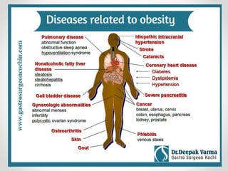 Obesity in America | PPTX