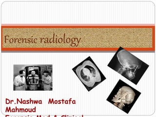 Forensic radiology
Dr.Nashwa Mostafa
Mahmoud
 