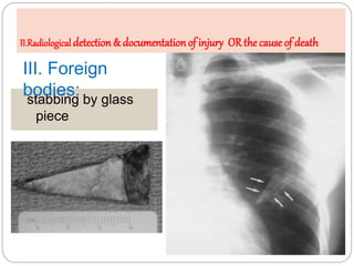Dicing Injuries Presentation forensic radiology | PPTX