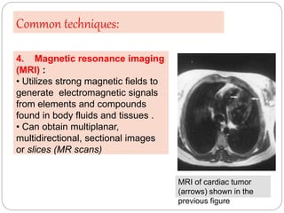 4. Magnetic resonance imaging
(MRI) :
• Utilizes strong magnetic fields to
generate electromagnetic signals
from elements ...