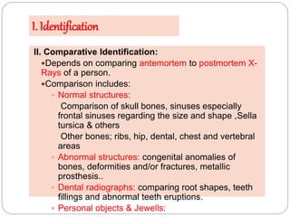 presentationforensicradiology_150419160811_conversion_gate02_2.pdf