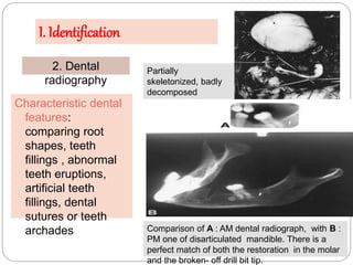 presentationforensicradiology_150419160811_conversion_gate02_2.pdf