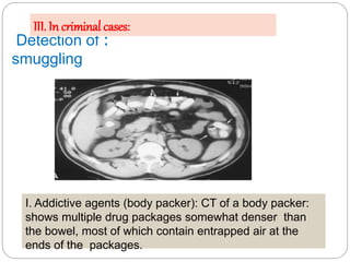 presentationforensicradiology_150419160811_conversion_gate02_2.pdf