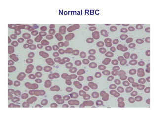 Approach To A Patient With Anemia | PPTX