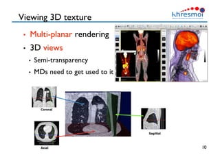 Viewing 3D texture
•  Multi-planar rendering
•  3D views
•  Semi-transparency
•  MDs need to get used to it
10
 