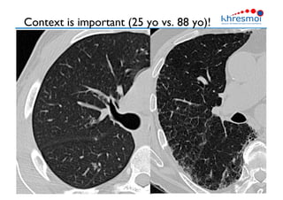 Context is important (25 yo vs. 88 yo)!
26
 