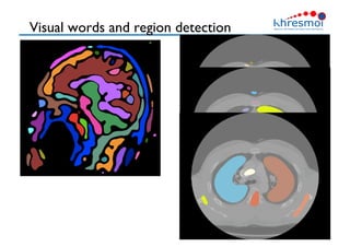 Visual words and region detection
33
 