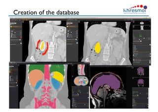 Creation of the database
37
 