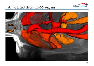 Annotated data (20-55 organs)
38
 