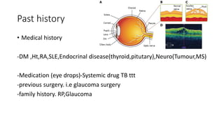 Past history
• Medical history
-DM ,Ht,RA,SLE,Endocrinal disease(thyroid,pitutary),Neuro(Tumour,MS)
-Medication (eye drops)-Systemic drug TB ttt
-previous surgery. i.e glaucoma surgery
-family history. RP,Glaucoma
 