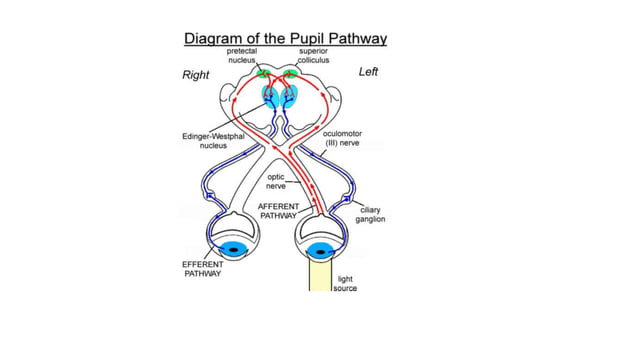 Gradual Visual loss.pptx