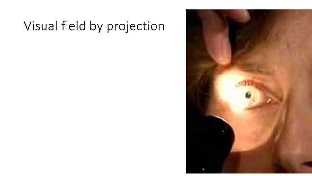 Gradual Visual loss.pptx