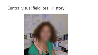 Central visual field loss,,,History
 