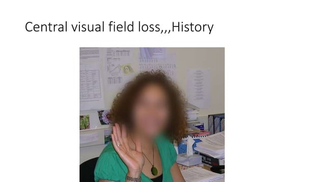 Gradual Visual loss.pptx